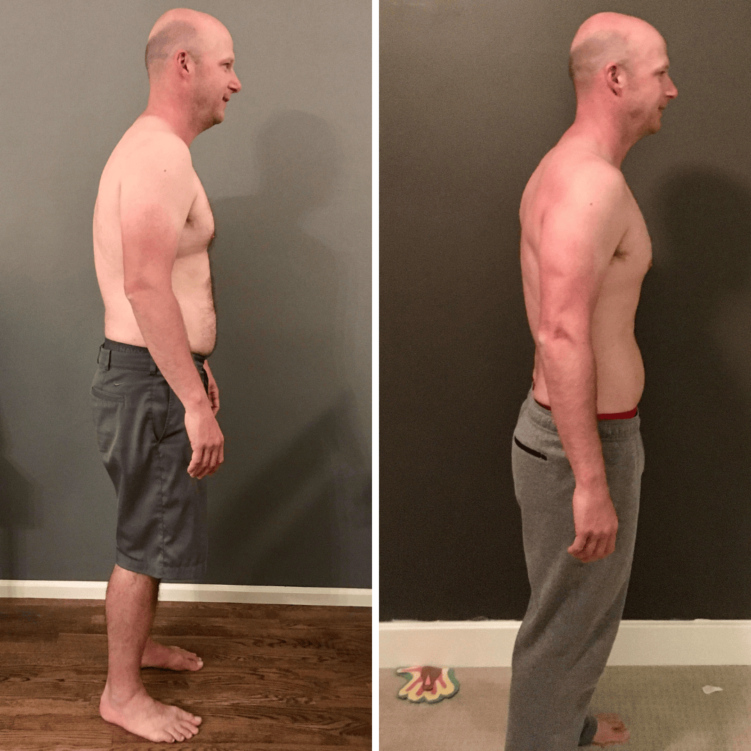 Nick's original side-view before and after photo comparison